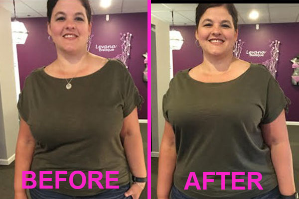 minimizer bra before and after