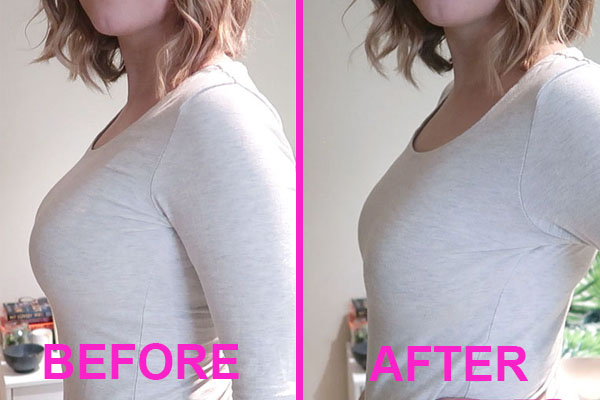 best minimizer bra before and after