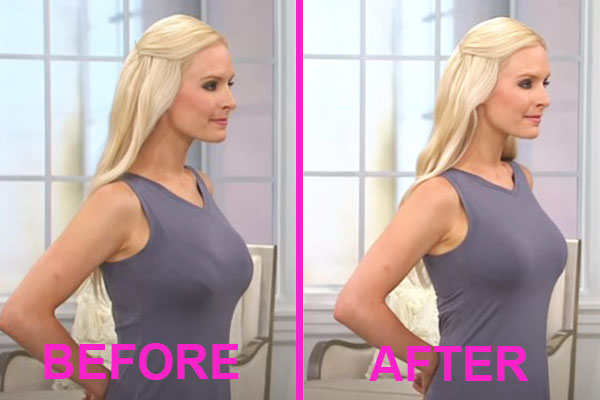 bra minimizer before and after