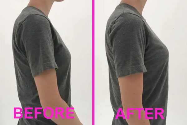 best minimizer bra before and after