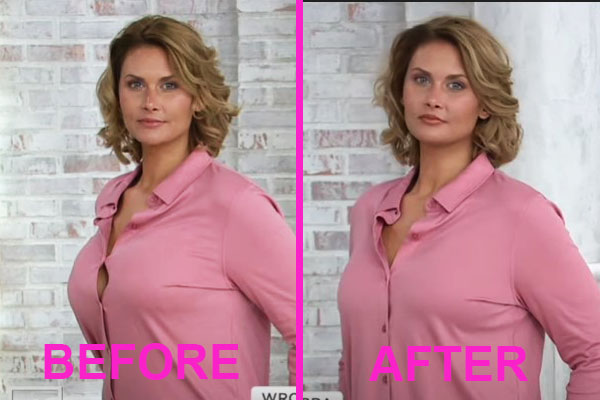 bra minimizer before and after