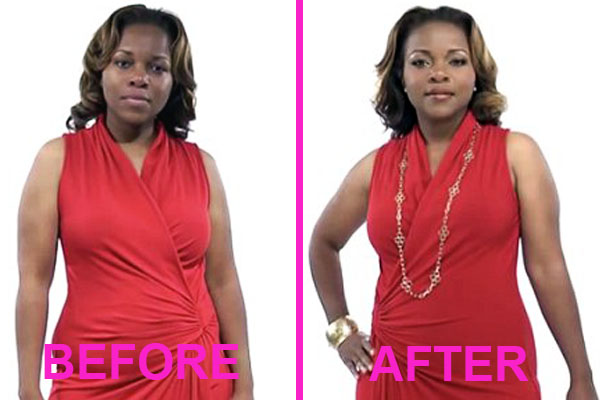 best minimizer bra before and after